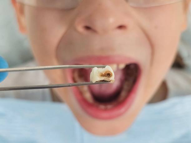 Best Emergency Dental Care for Trauma or Injury in Danville, AR